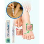 Orivelle Anti-Fungal Pen